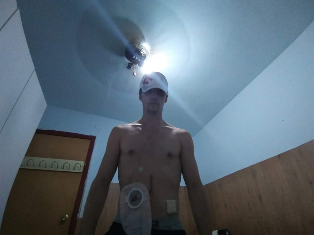 Proceso de recuperación personal con enfermedad inflamatoria intestinal