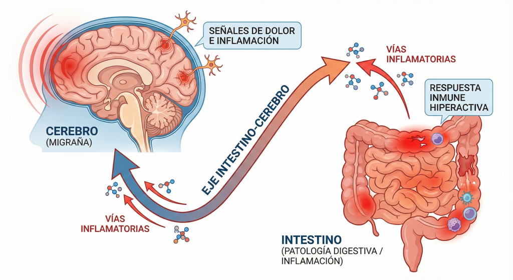 Migraña y EII