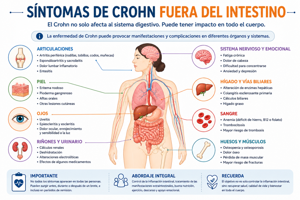 síntomas de Crohn fuera del intestino